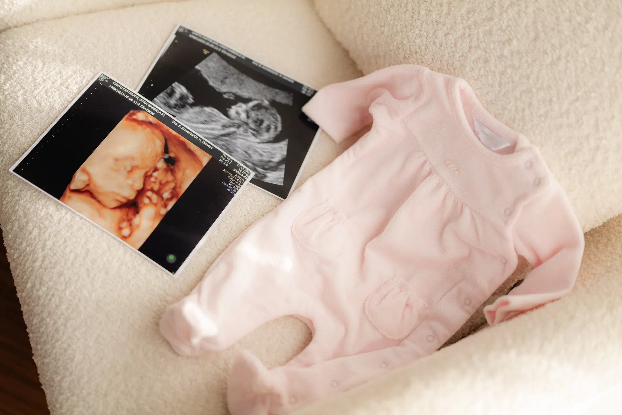Un ultrasonido y un conjunto rosa de bebé sobre una tela blanca.